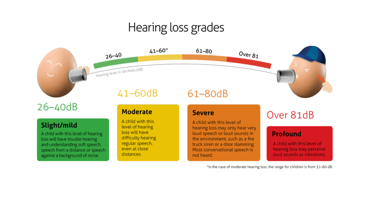 Hearing перевод. Hearing loss Grades. International classification of hearing loss. Hearing Level (DB hl). Hearing loss degree.